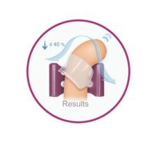andropeyronie-vertical.png_product